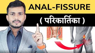 Anal Fissure Treatment In Kochi