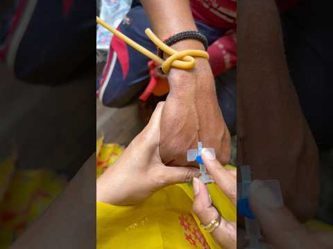 Iv cannulation process