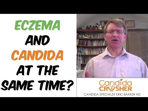 Cura di psoriasi delle dita Cura di psoriasi da acido fumaric