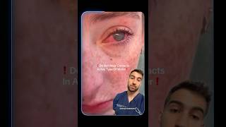 POV: You Wore Contacts in Water