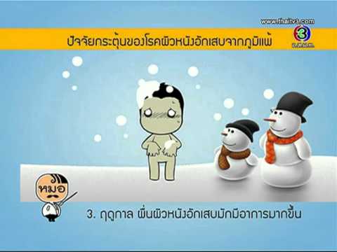 กลากและต่อมลูกหมากอักเสบ รูปแบบ seborrheic ของโรคสะเก็ดเงิน