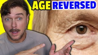 4 Ways To Reverse Age Your Eyes | Chris Gibson