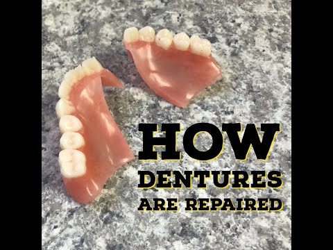 How Dentures Are Repaired/Fixed