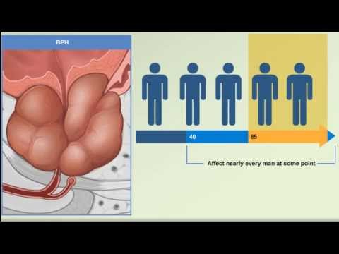 Tetracyclin-Antibiotika für Prostatitis Prostata bei Männern Symptome Behandlung Forum