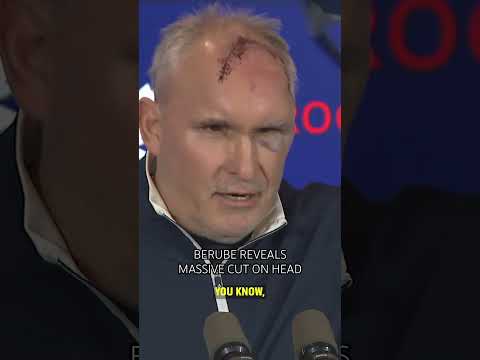 Craig Berube reveals massive cut on head from a gym accident. 😳 🤕