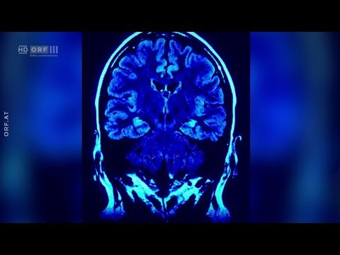 Alzheimer: Essen gegen das Vergessen ORF treffpunkt medizin