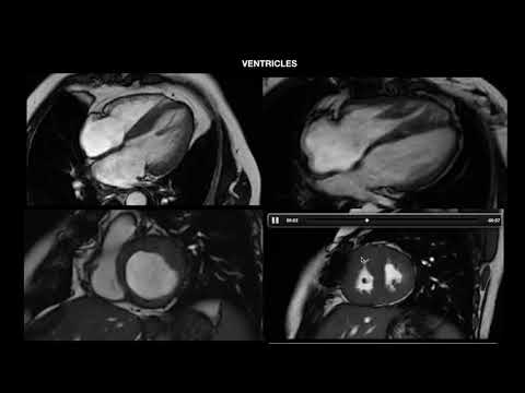 4. CMR Anatomy and Imaging Planes