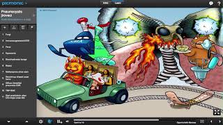 Pneumocystis jiroveci