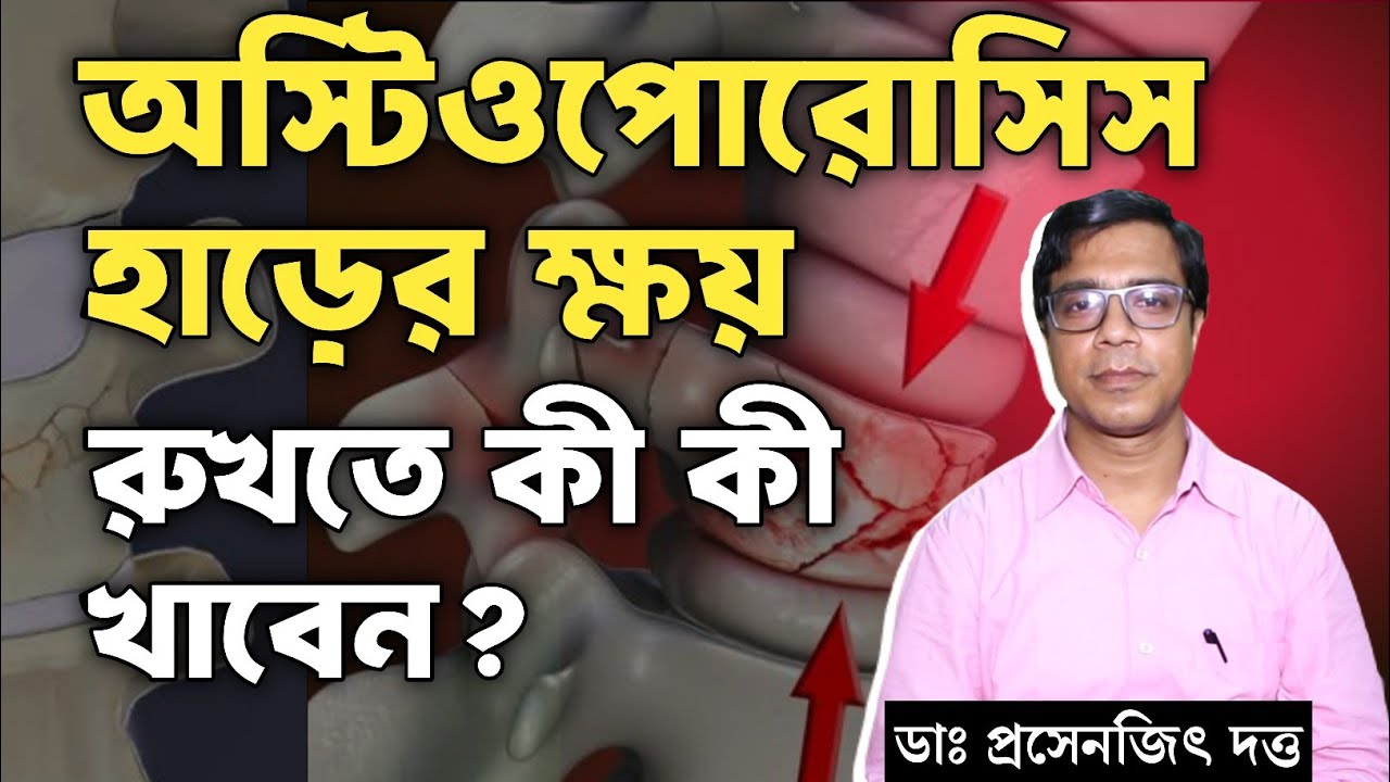 হাড় ক্ষয় হলে কি খেতে হবে? | হাড় ক্ষয় রোধ করার সহজ উপায় । How to Prevent Osteoporosis?