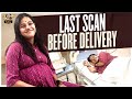 Last Scan Before Delivery Pregnancy Journey 39th Week Scan Vaishali Sathyadev