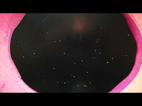 Americium 241 alpha radiation modified camera ccd