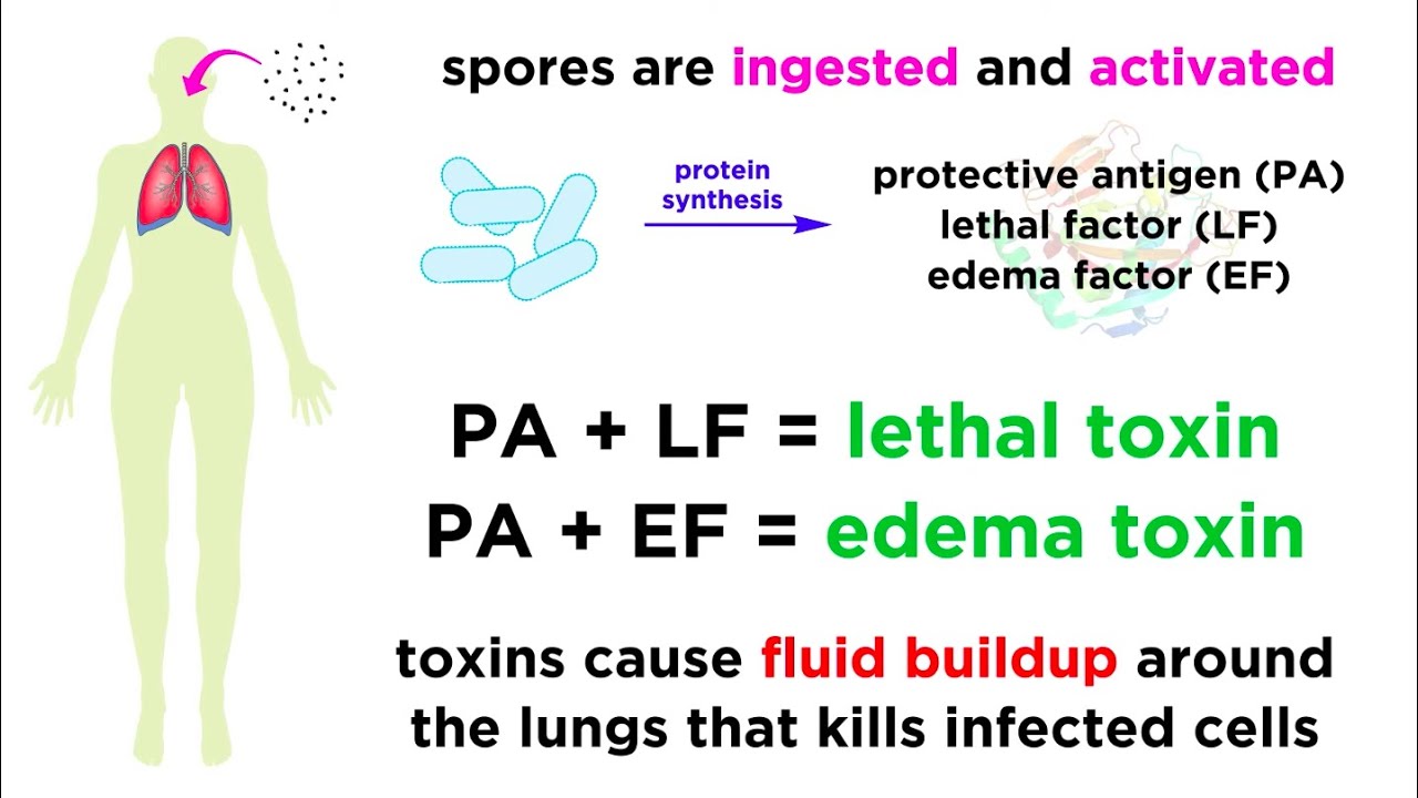 What are the three main forms of anthrax in humans?