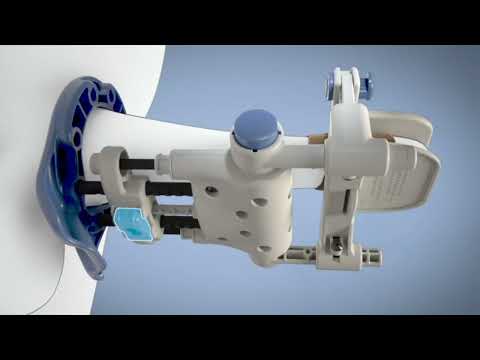 Pathright Medical RestoreX for Peyronie’s disease - Ghost Medical