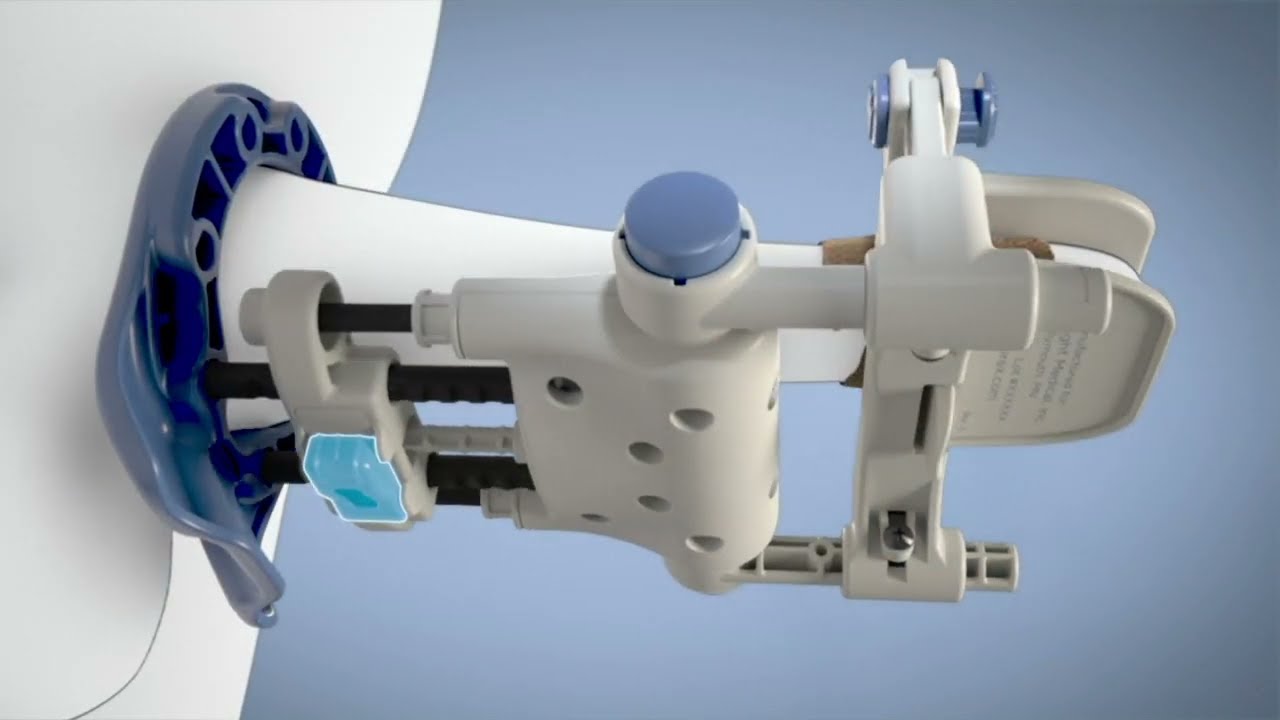 Pathright Medical RestoreX for Peyronie’s disease - Ghost Medical