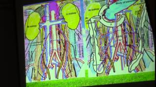 18) Dr.Sherif Zaky15/3/2015 [Pancreas-ProtoSystemic Anastomosis]