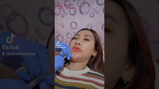 Download lagu filler bibir mp3 Download lagu filler bibir mp3