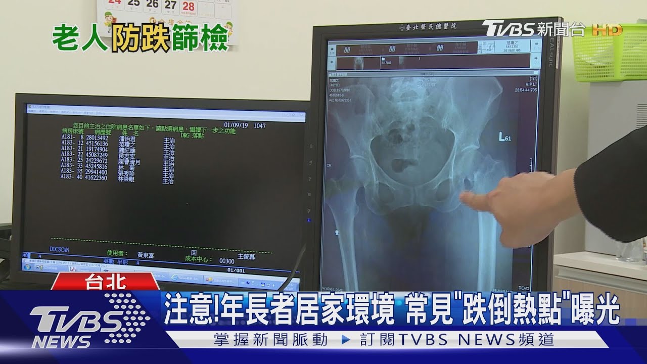 注意! 居家環境常見「跌倒熱點」曝光 醫:發生憾事恐癱瘓