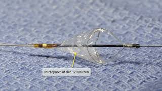 Carotid Artery Stenting - Tips &  Tricks