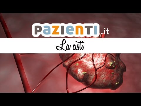 E in Dikul unguento per giunti Rimedi popolari hip trattamento coxartrosi