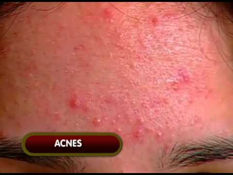 Chamada do programa Assunto Do Dia / Cravos e Espinhas / RBC TV