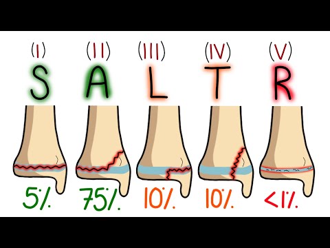 Salter-Harris Classification Made Easy To Remember