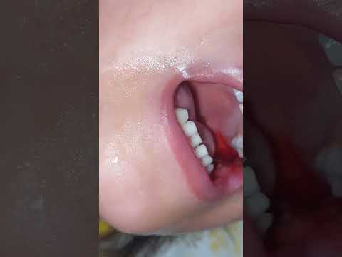 Obrazek poglądowy filmu YouTube