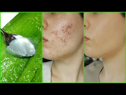 How To Use ALOE VERA On Face for Clear Spotless Skin│How To Exfoliate with ALOE VERA for Smooth Skin