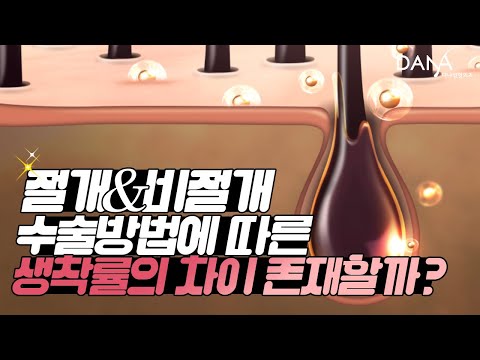 의느님답변????ㅣ절개,비절개 간에 모낭 생착률 차이 존재할까요?ㅣ모낭생착률ㅣ모발이식ㅣ다나성형외과(DANA)