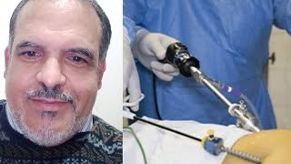 ضرورة إجراء عمليتين جراحيتين بالليزر لاستئصال حجر الكلاوي حجم كبير 