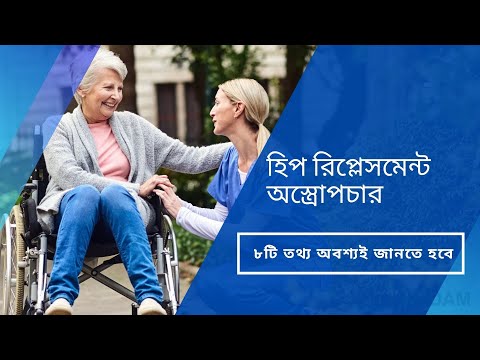 হিপ প্রতিস্থাপন অস্ত্রোপচার - ৮ টি তথ্য যা আপনার অবশ্যই জানা উচিত