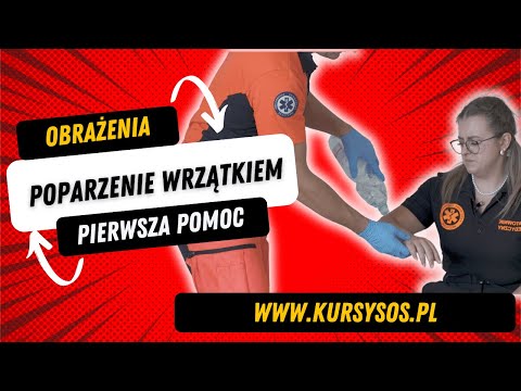 Oparzenie ręki #oparzenie # pierwszapomoc