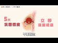 乳房摸到腫塊就是乳癌嗎？鄭明輝醫師：5大乳癌徵兆是警訊