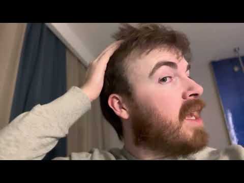 Day 0: The Night before my Hair of Istanbul transplant