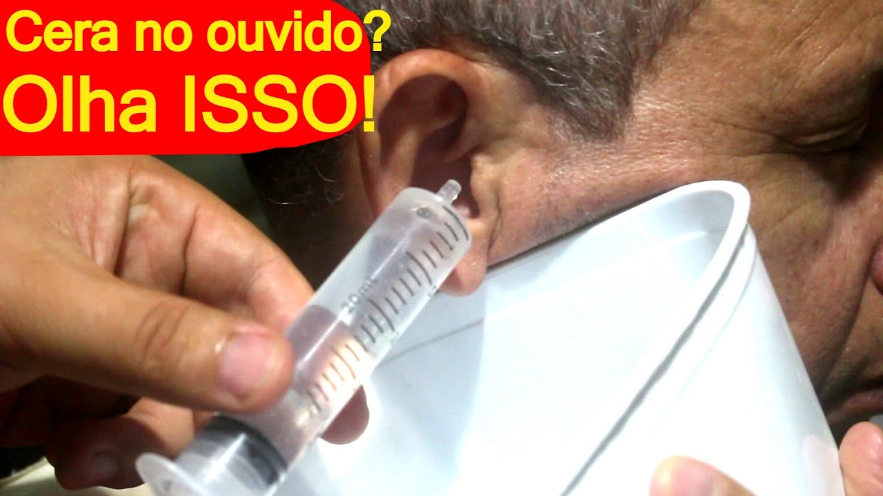 Como Desentupir o Ouvido em casa tirar cera do ouvido com soro