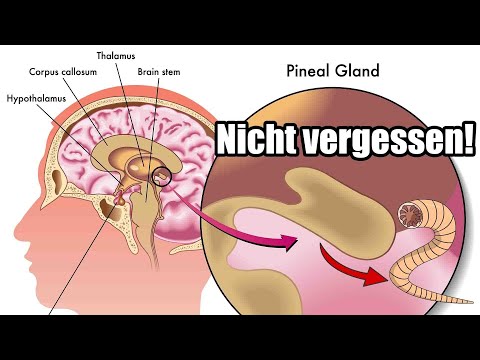 Parasite cleanse - Please don't forget this important detail! 🧠 The pineal gland as a parasite ki...