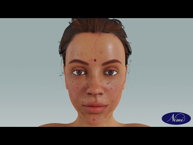 Client Drape & skin Analysis