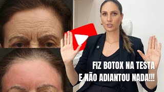 Fiz botox na testa e não adiantou nada!!
