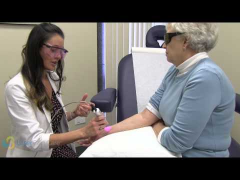 download lagu mp3 mp4 Cold Laser Therapy Boca Raton Fl, download lagu Cold Laser Therapy Boca Raton Fl gratis, unduh video klip Cold Laser Therapy Boca Raton Fl