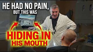 Patient had no pain! But this was hiding in his mouth!