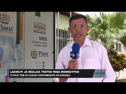 LACEN-PI realiza testes para Monkeypox e Piauí registra 39 casos 27 02 2023