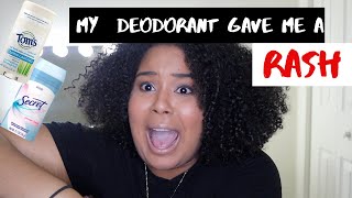 NATURAL DEODORANT GAVE ME AN ARMPIT RASH | ARMPIT DETOX GONE WRONG | STORY TIME WITH LESLIE