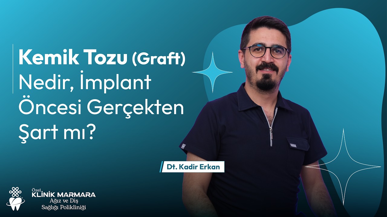 Kemik Tozu Graft Nedir, İmplant Öncesi Gerçekten Şart mı?