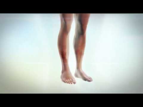 How To: Spot the Signs of Vascular Disease