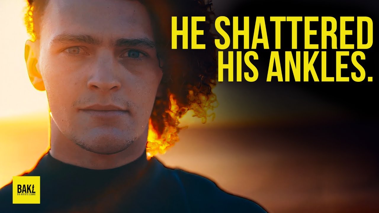 He SHATTERED his ankles kitesurfing