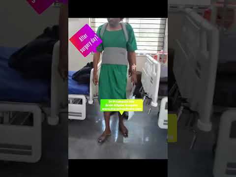 Spine Decompression & Fusion Surgery with Kyphosis Correction