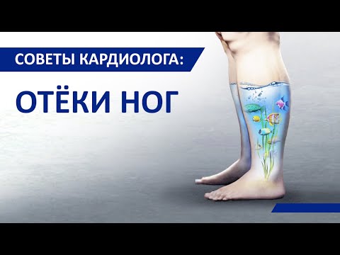 Советы кардиолога Сергиенко: Отёки ног