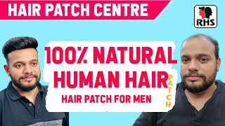 Special Offer Human Hair Patches And Wigs At Affordable Prices | Hair Patch For Men | 9599858612