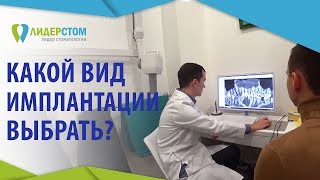 Виды имплантации зубов. 👐 Подробно о всех видах и этапах имплантации зубов. ЛидерСтом. 12+