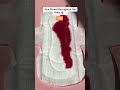 Your period flow will change with your age. Watch to see what your future flow holds🩸🤩