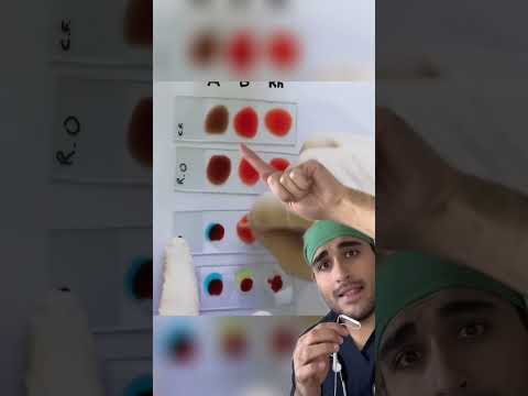 Doctor explains: How to know your blood type?!🤯🤯